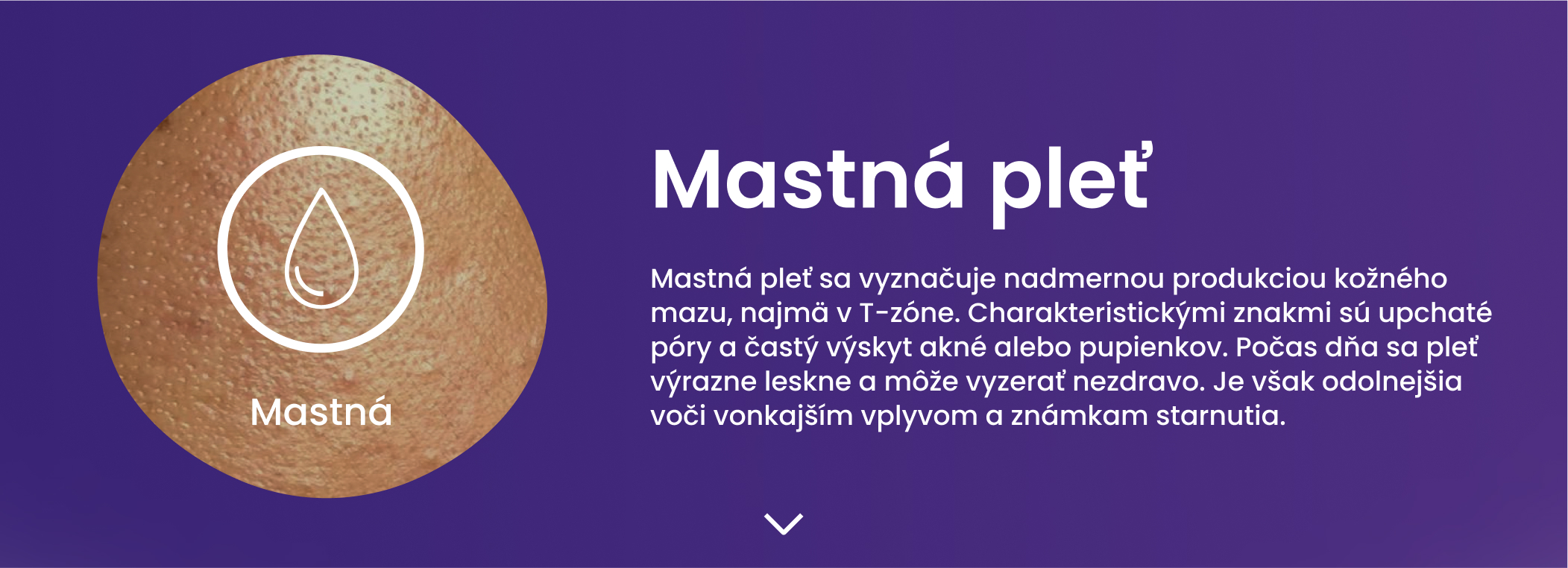 Mastná pleť