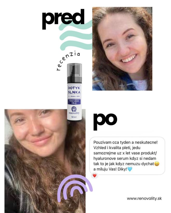 Tónovacia hmla 🌸 a tvoja pleť získa opálenejší, sviežejší a sebavedomejší feeling 🤌🏻 💧 Hydratuje ako sérum, vyzerá ako...